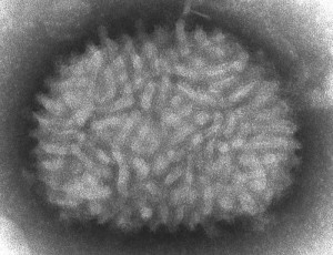 Vaccinia Virus, Source: Wikimedia Commons